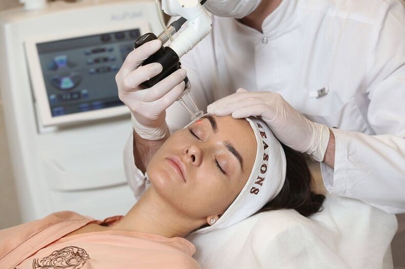 Peremajaan kulit dengan laser yang halus