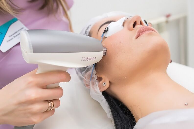 melakukan prosedur peremajaan kulit dengan laser